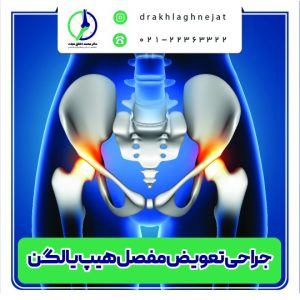 تعویض مفصل هیپ یا لگن