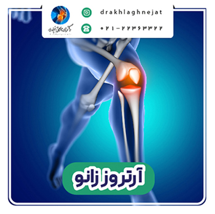 آرتروز زانو knee arthritis